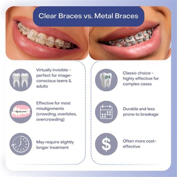 Are clear braces more comfortable?