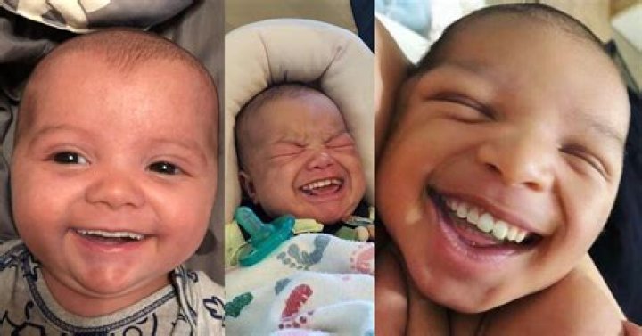 Are we born with all teeth?