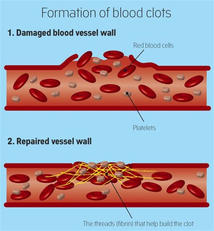 Can alfalfa cause blood clots?