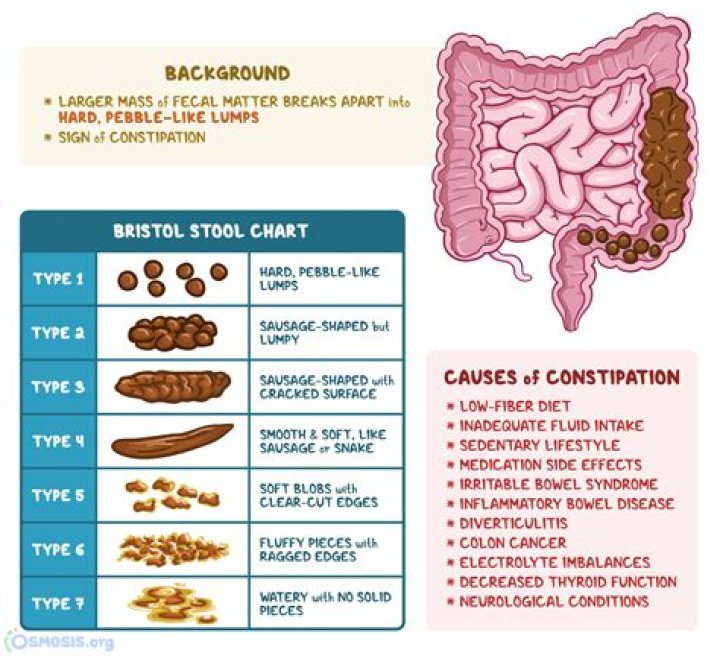 Can constipation cause perforated bowel?