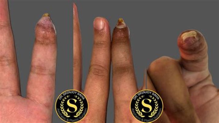 Can frogs regrow fingers?