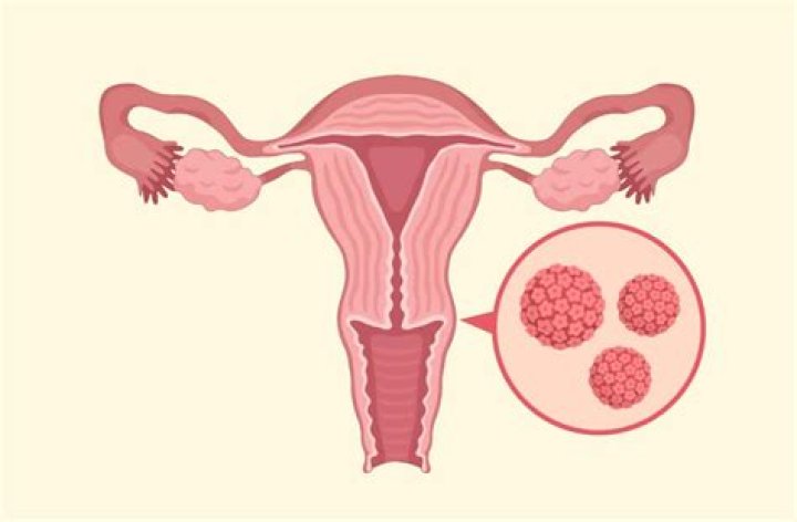 Can HPV cause infertility?