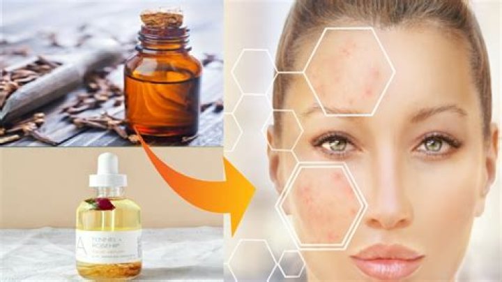 Can I mix vinegar and clove oil?