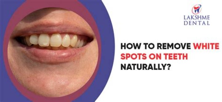 Can I scrape off white spots on tonsils?