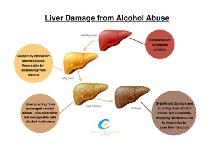 Can liver damage recover from alcohol?