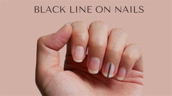 Can nail polish turn your nails black?