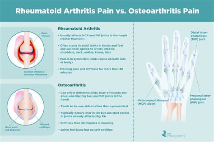 Can osteoarthritis cripple you?