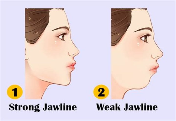 Can teeth affect your jawline?