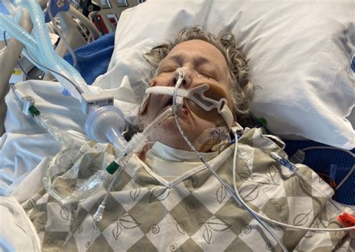 Can you breathe in a coma?