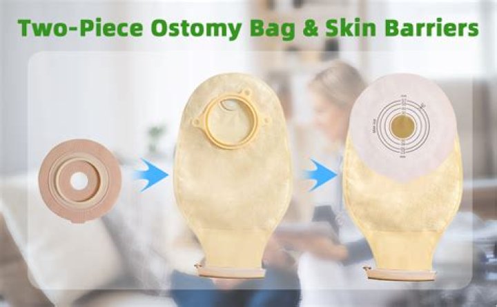 Can you eat candy with an ostomy bag?