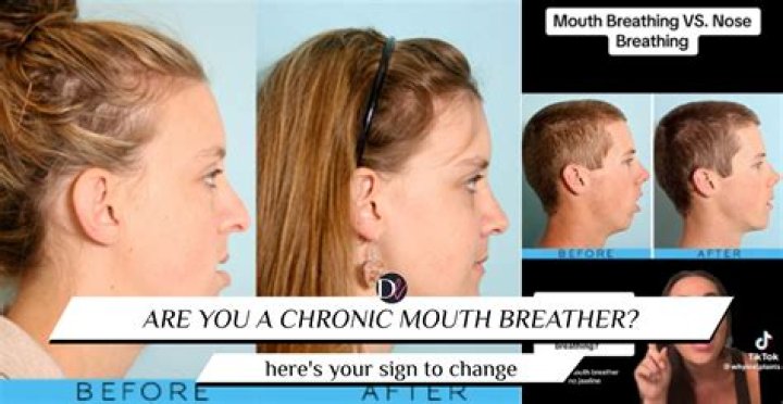 Can you fix mouth breathing?