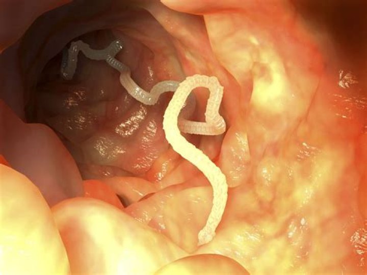 Can you see a tapeworm in your stool?