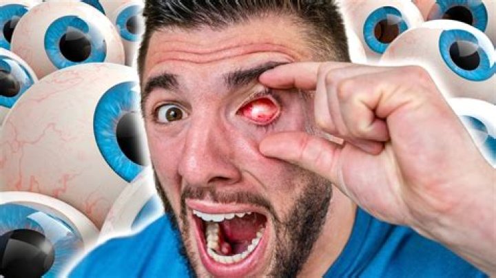 Can your eyeballs fall out?
