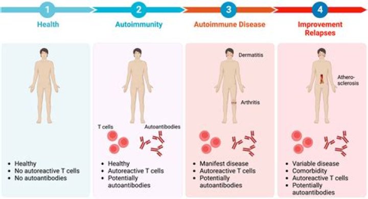 Do neurologists treat autoimmune diseases?