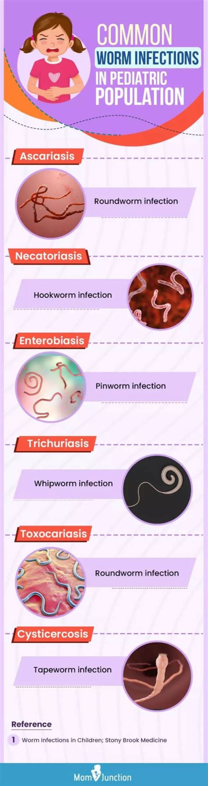 Do pinworms cause itching all day?