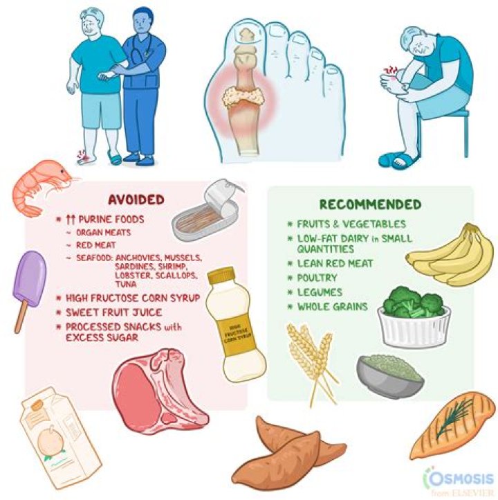 Do you pee out uric acid?