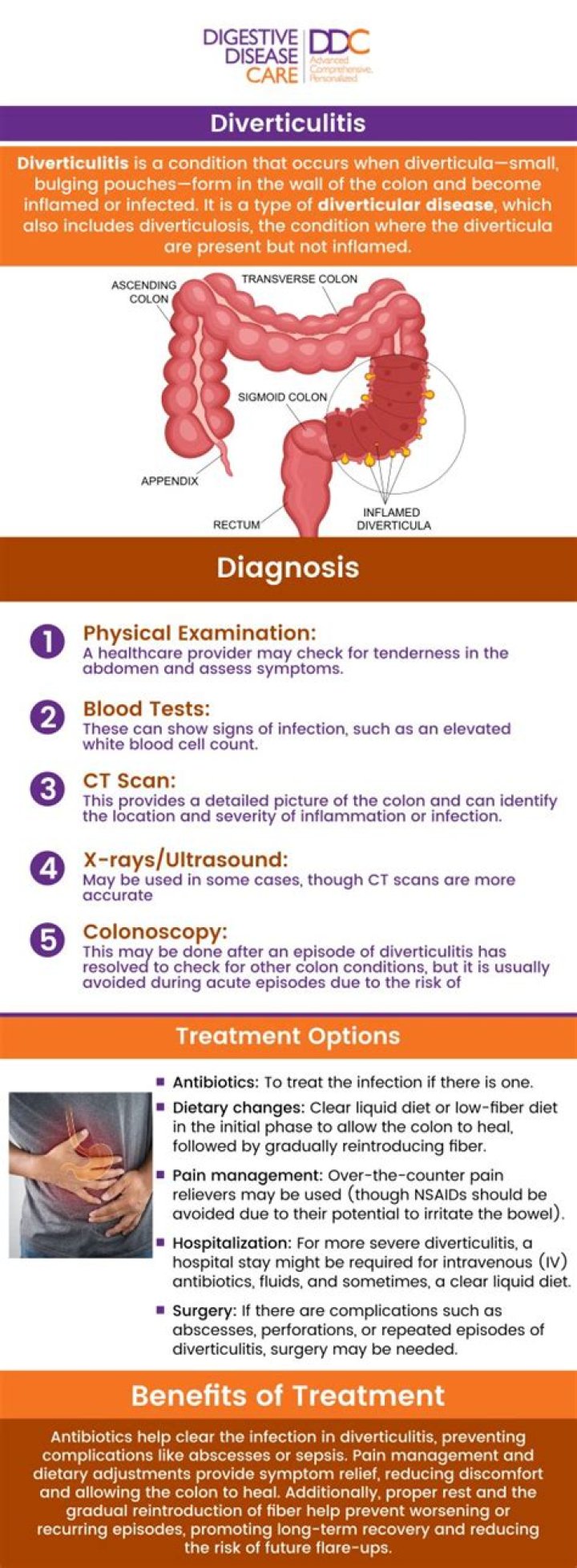 Does diverticulitis cause low back pain?