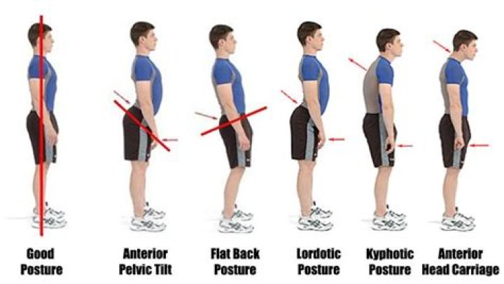 Does farmers walk fix posture?