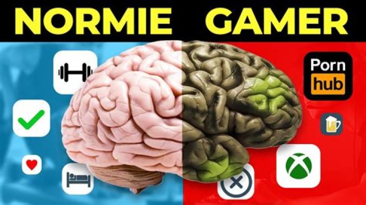 Does gaming cause brain damage?