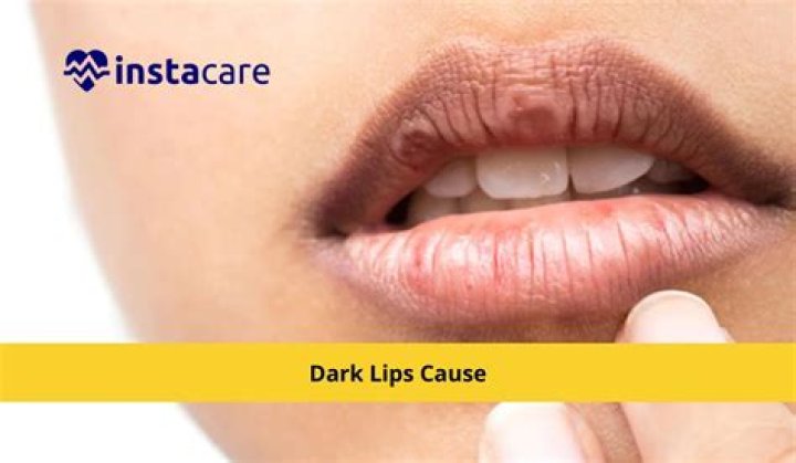 Does licking lips cause darkness?