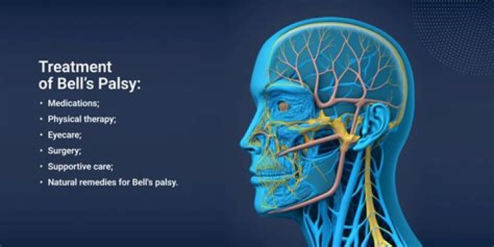Does Vitamin D Help Bell's palsy?