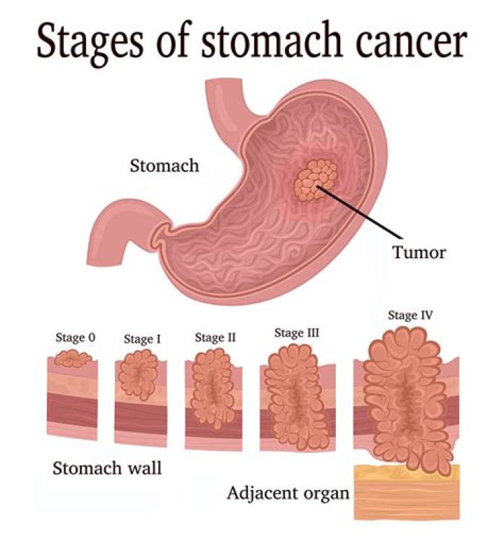 How do I know if I have a tumor in my ear?