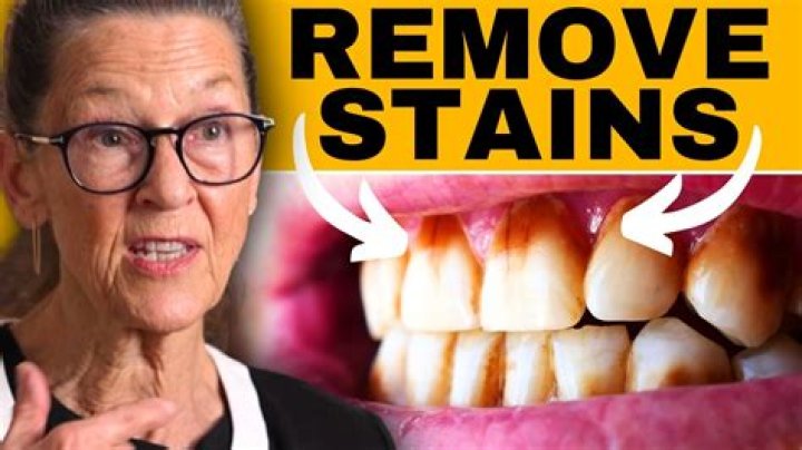 How do I remove stains from Invisalign?