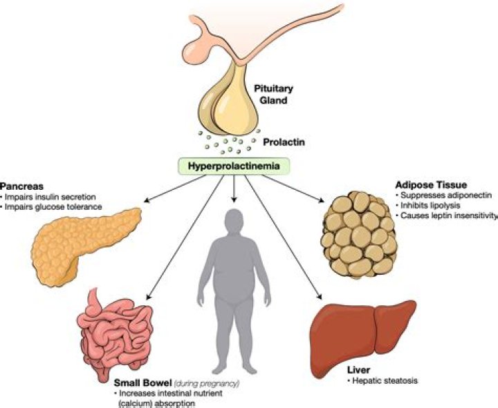 How do you get galactorrhea?
