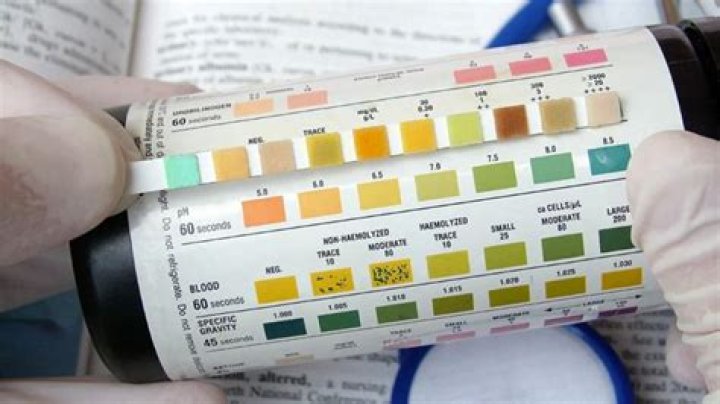 How do you pass a Delta 8 urine test?