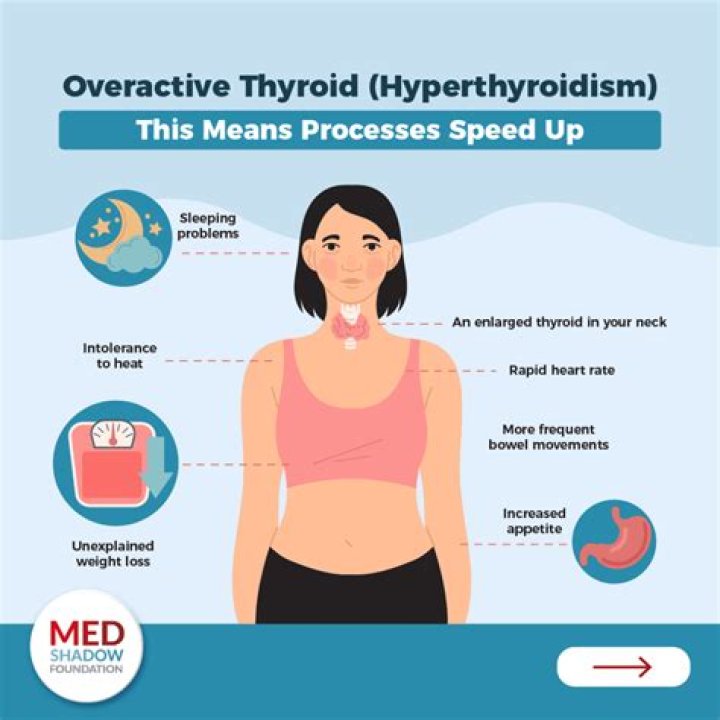 How does thyroid affect sleep?