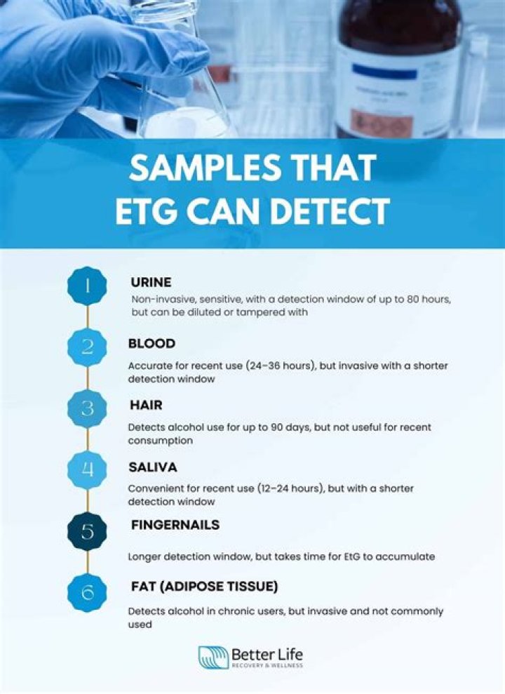 How sensitive is EtG?