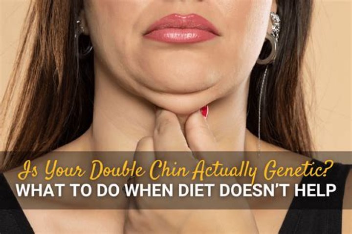 Is a small chin genetic?