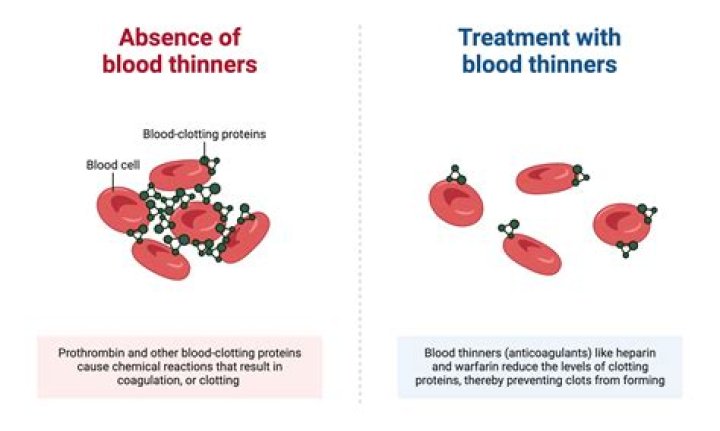 Is Advil blood thinner?