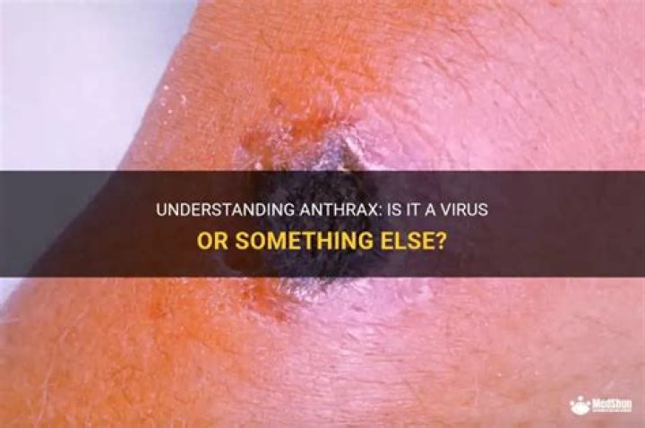 Is anthrax a virus?