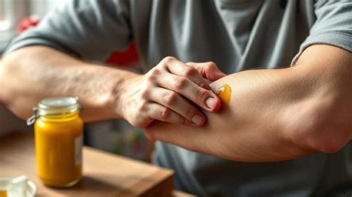 Is mustard good for burns?