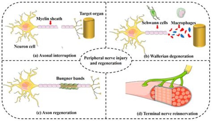 Is nerve regeneration possible?