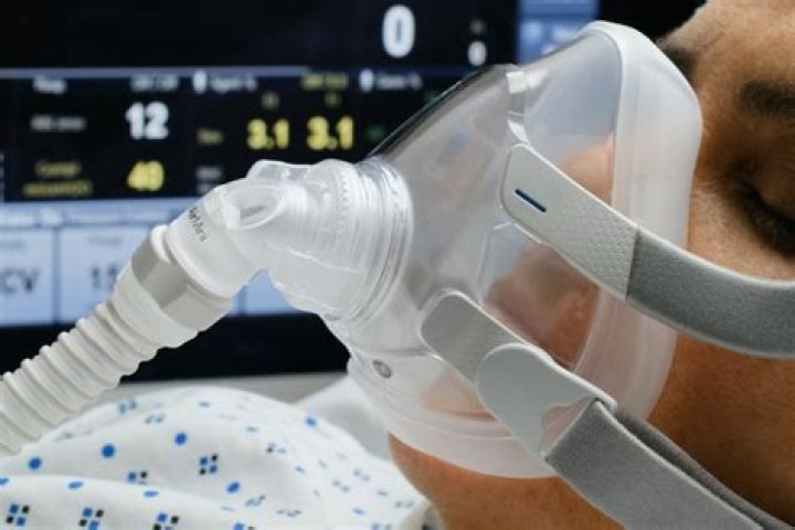 Is ventilator life support?