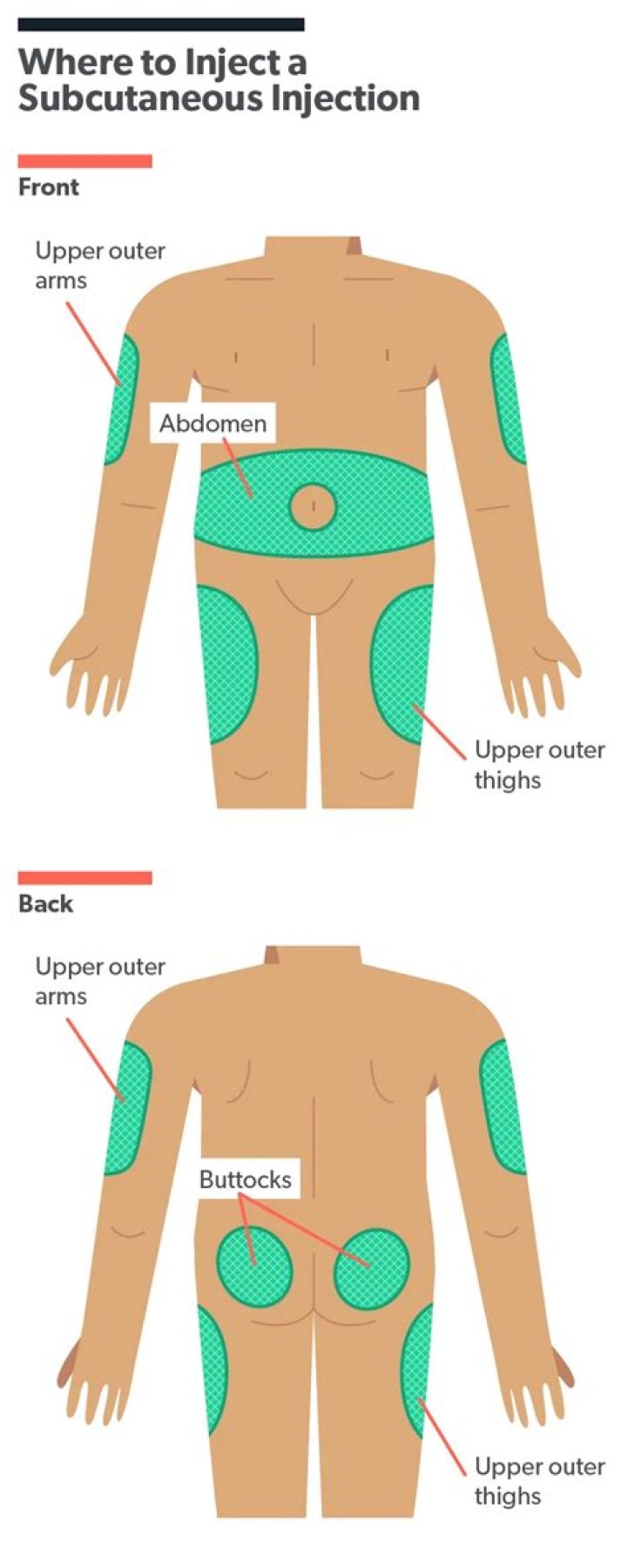 Should you bleed after a subcutaneous injection?