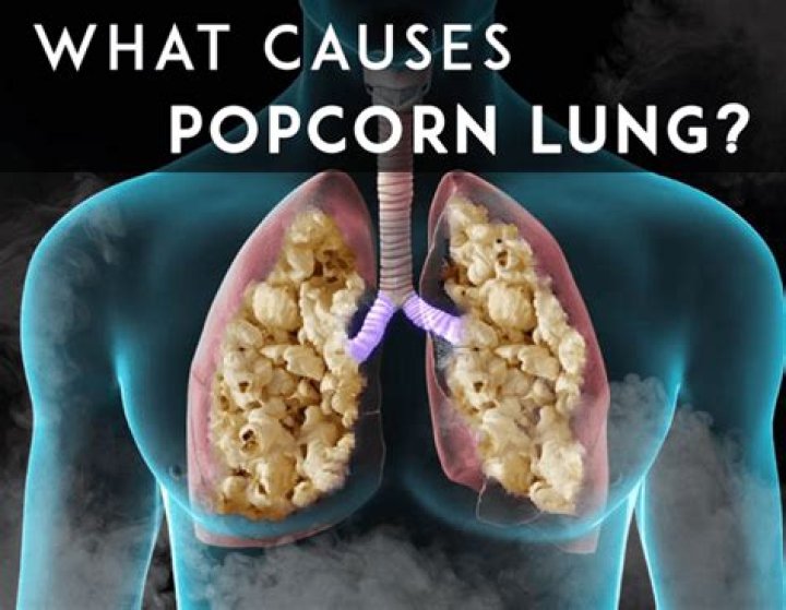 What causes popcorn lung?