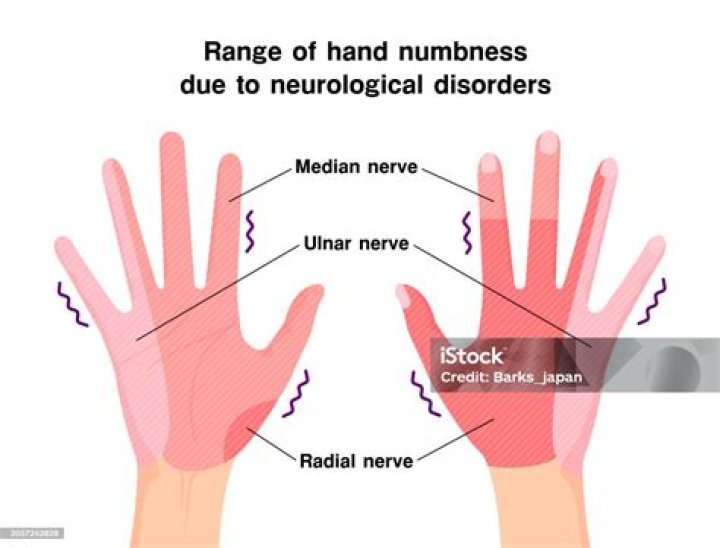 What does nerve damage feel like in your hand?