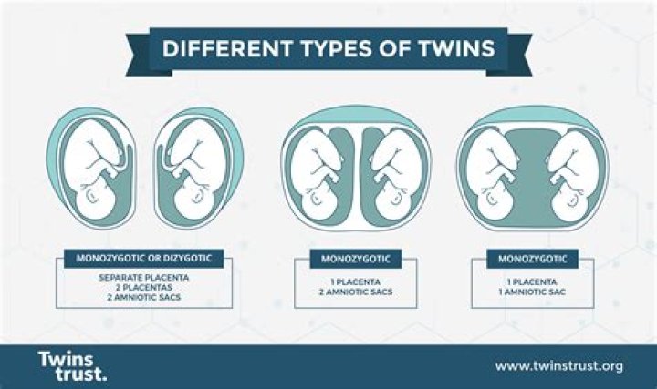 What happens if one identical twin dies in the womb?