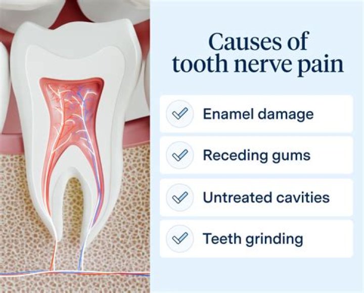 What happens if wisdom tooth hits nerve?