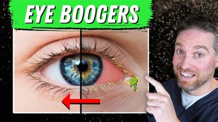 What is eye boogers made of?