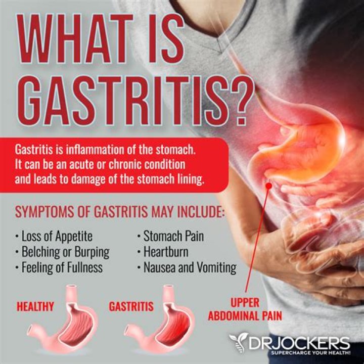 What is severe gastritis?
