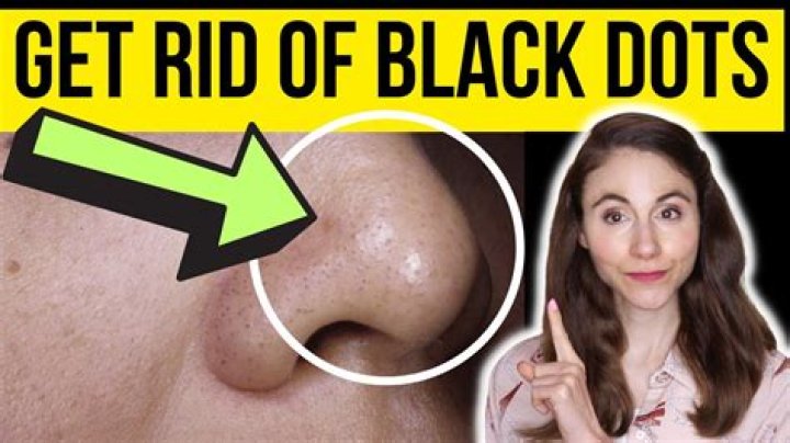 What is the black stuff on my retainer?