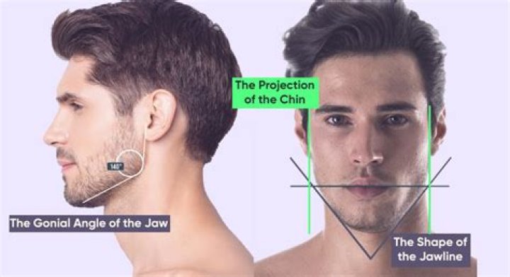 What is V-shaped jaw?