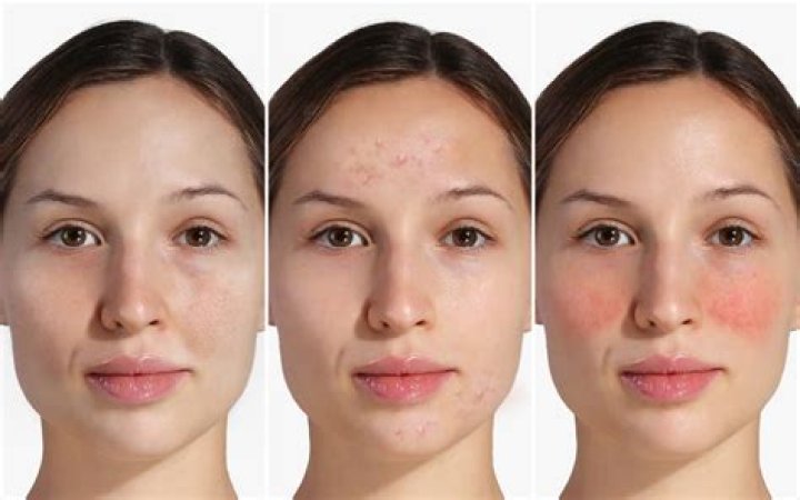 What is wine face?