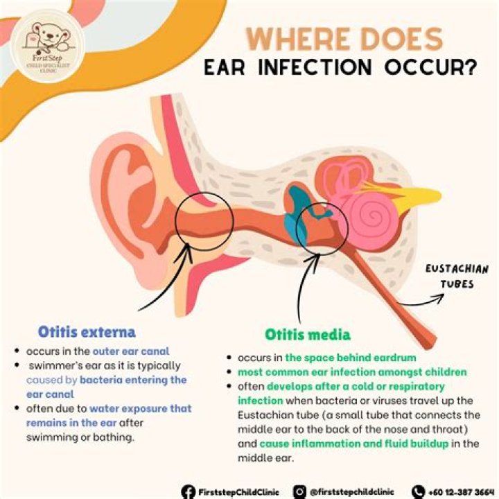 When should I be concerned about an ear infection?