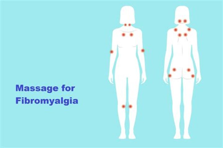 Where does fibromyalgia start?