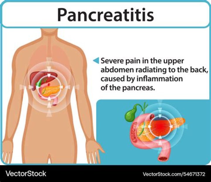 Where is the pain of pancreatitis felt?